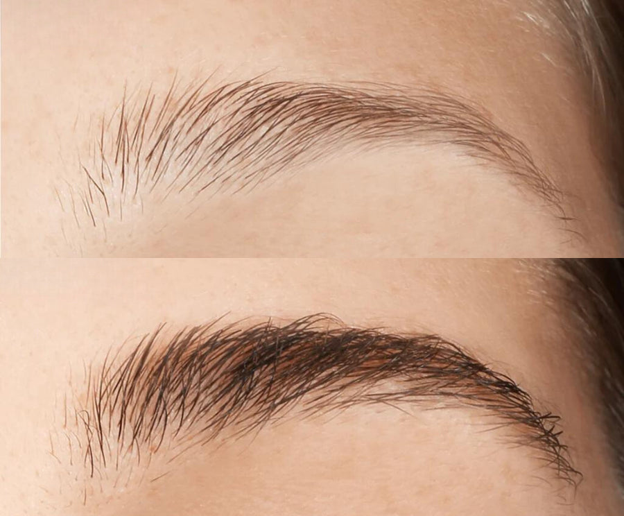 effetto siero sopracciglia