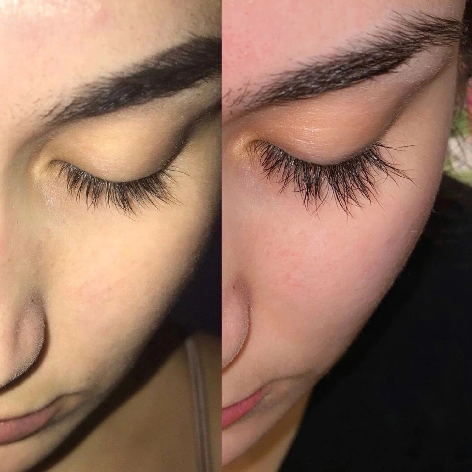 prima e dopo siero ciglia