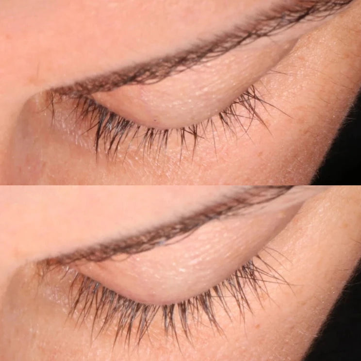 risultato siero ciglia